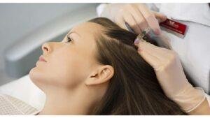 Mesotherapy for Hair Loss In Chandigarh